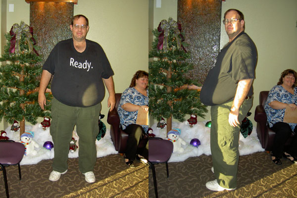 Before Surgery - 368 pounds